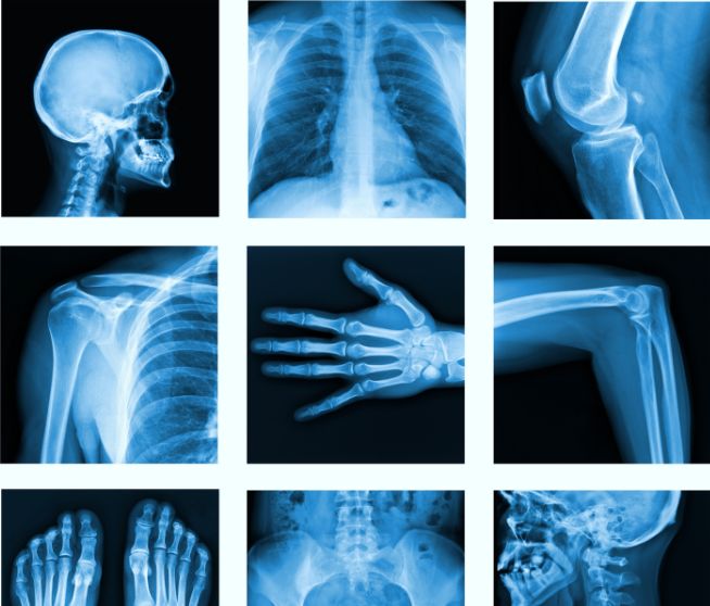 Why Is Medical Imaging Important in a Personal Injury Case?